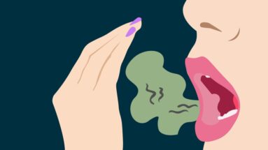 Bad Breath